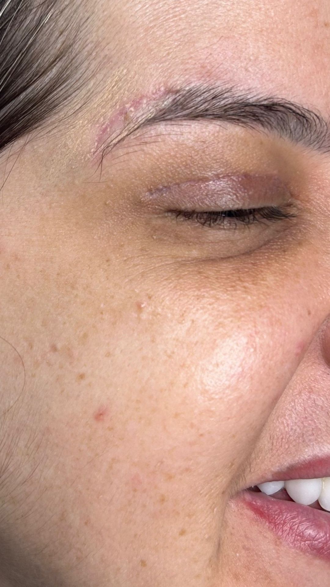 BOTOX (2) BOTOX (2)